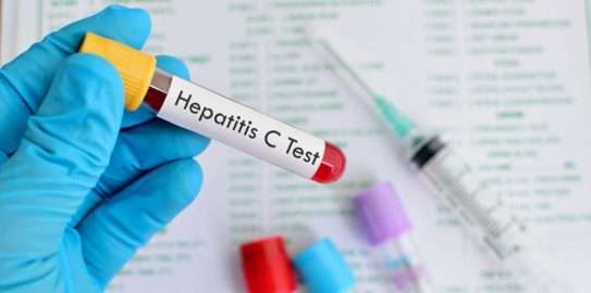 Es importante realizarse "al menos una vez en la vida" el test de la Hepatitis C.